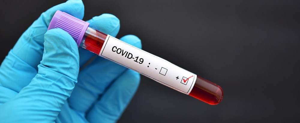Bedrijfsschade door het coronavirus: Valt er wat tegen te doen?
